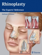 Rhinoplasty Reference Guide